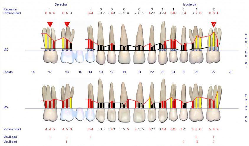 Periodoncia