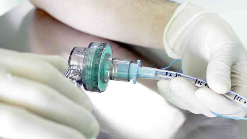 Anestesia en dentista