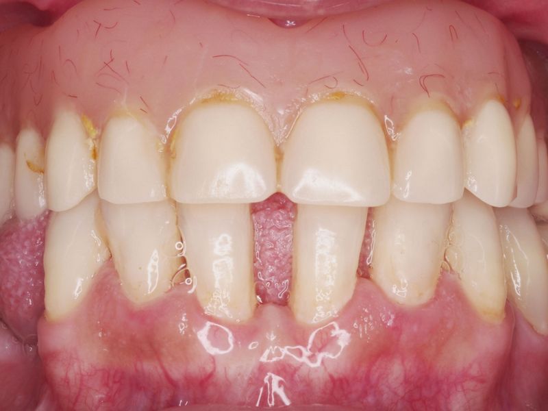 Antes y despues clínica dental. Casos clínicos dentales