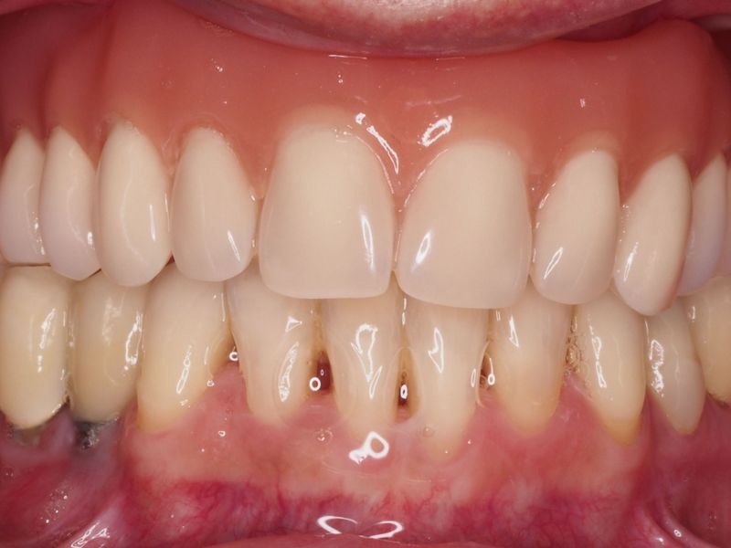Antes y despues clínica dental. Casos clínicos dentales