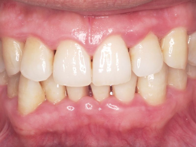 Periodoncia Sevilla