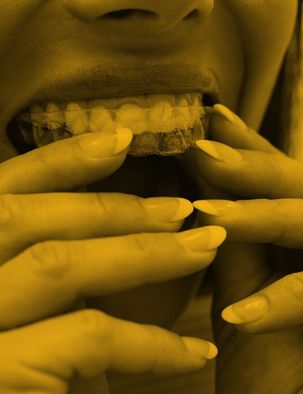 Close-up of female patient wearing braces in dental clinic