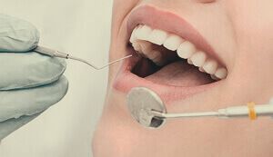 Cirugía dental Sevilla