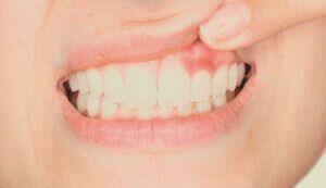 Periodoncia Sevilla